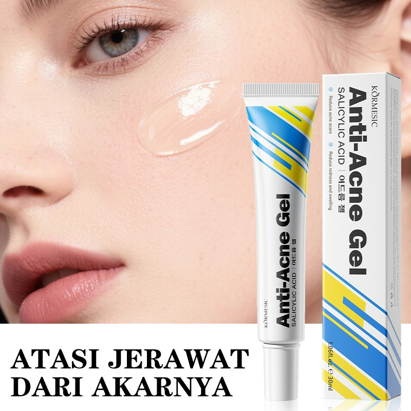 kormesic anti acne gel salycylic acid 30ml/obat totol jerawat kormesic anti acne gel salycylic acid 30ml/obat totol jerawat