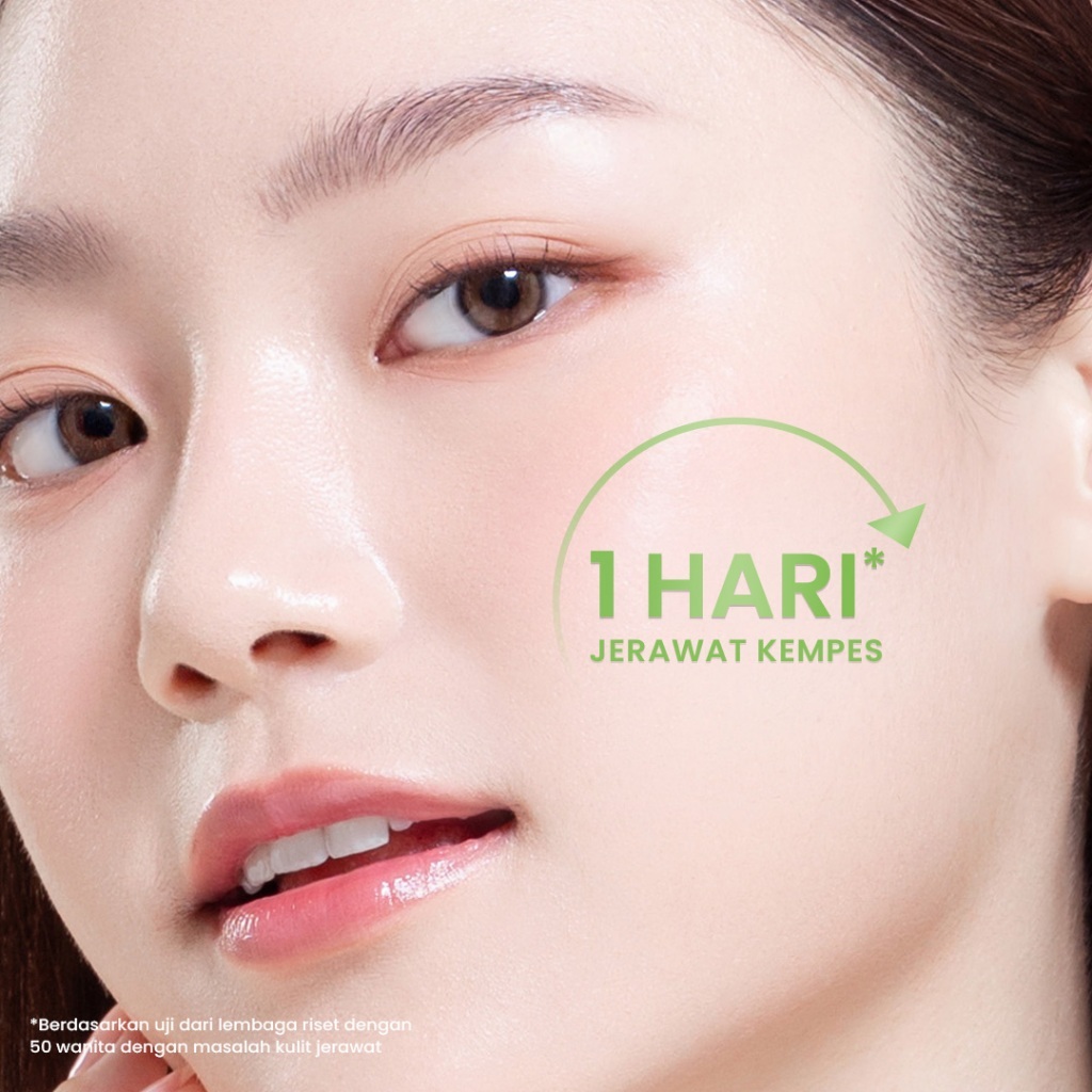 hanasui acne expert spot gel 15g/obat totol jerawat hanasui acne expert spot gel 15g/obat totol jerawat