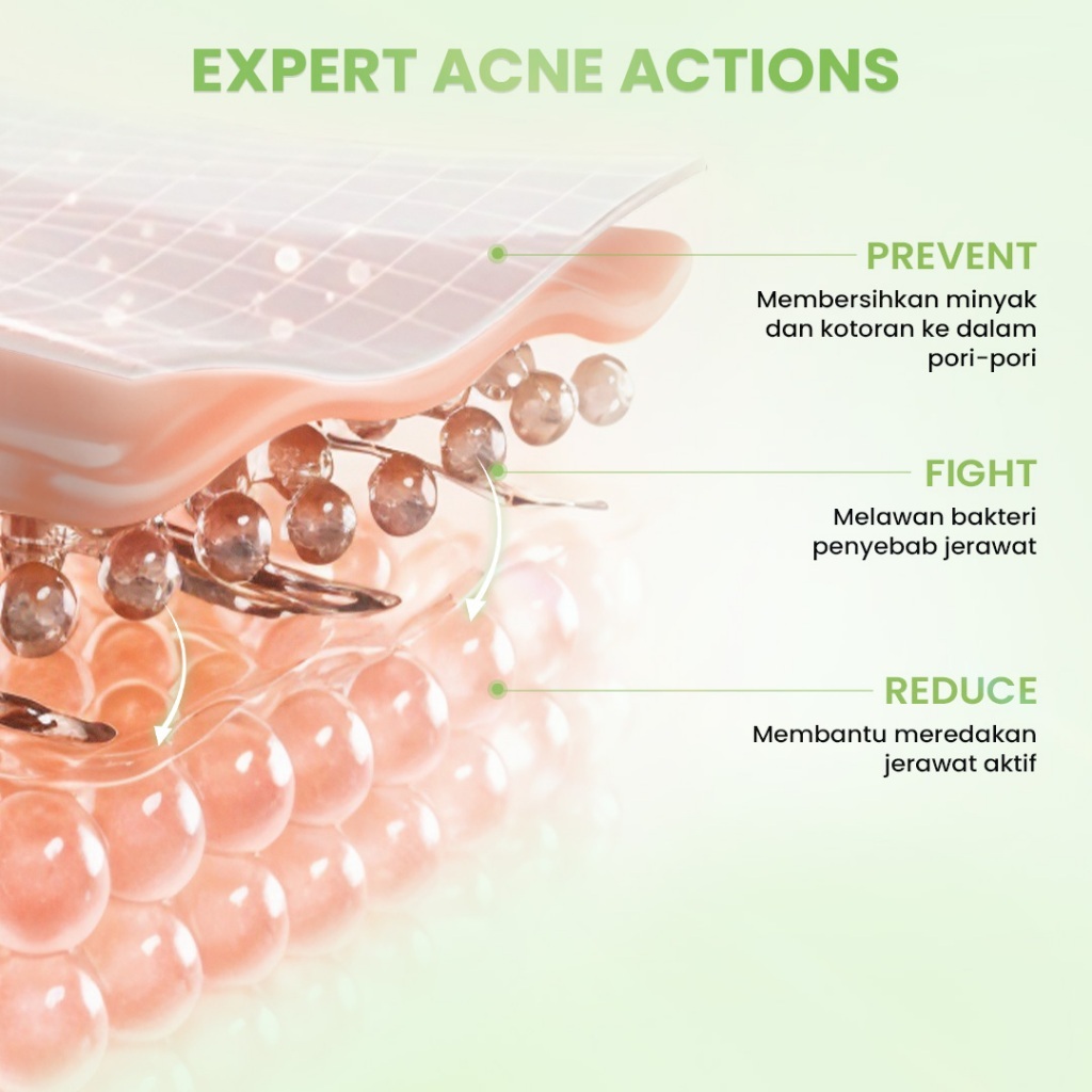 hanasui acne expert spot gel 15g/obat totol jerawat hanasui acne expert spot gel 15g/obat totol jerawat