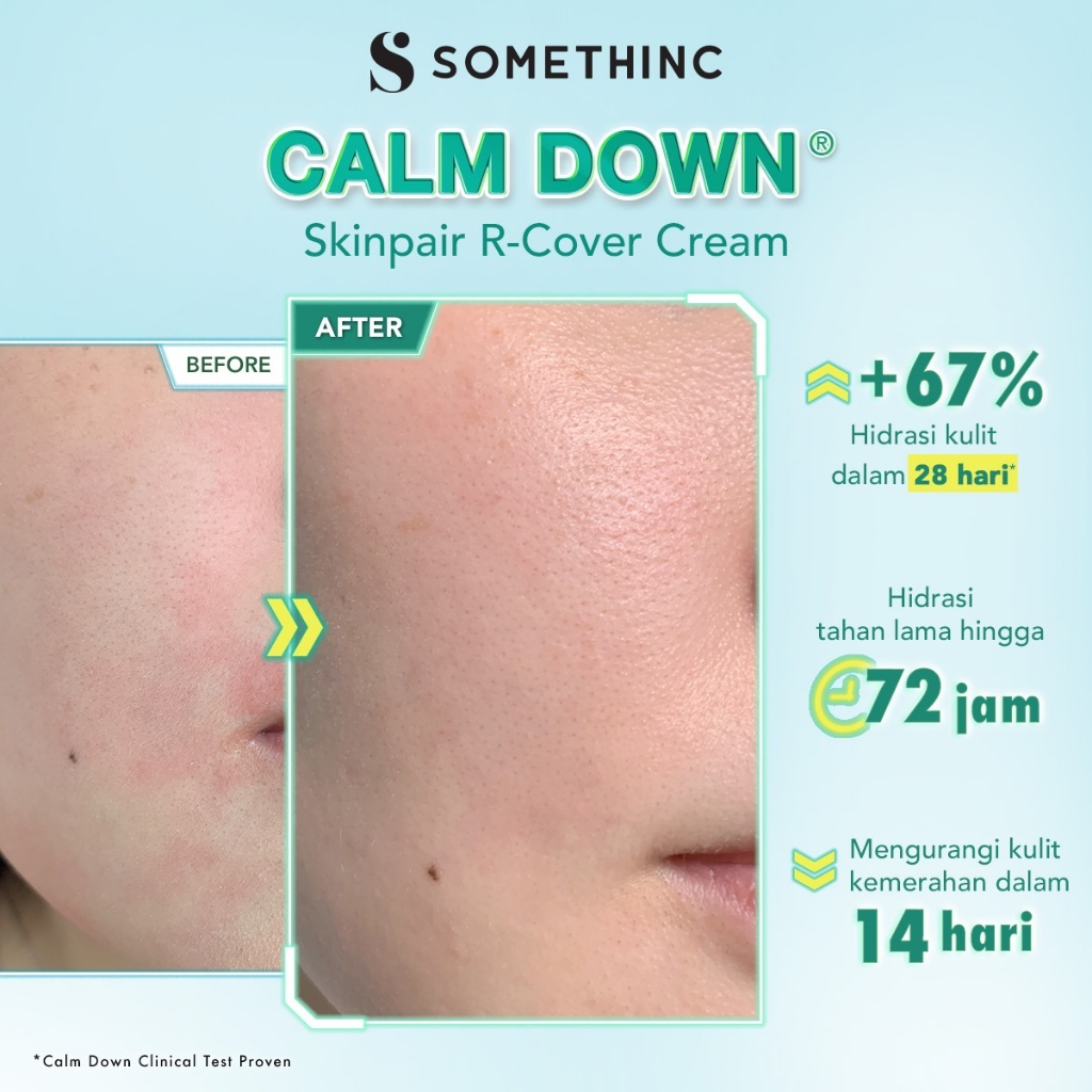 somethinc calm down skinpair r cover cream moisturizer/pelembab wajah somethinc calm down skinpair r cover cream moisturizer/pelembab wajah