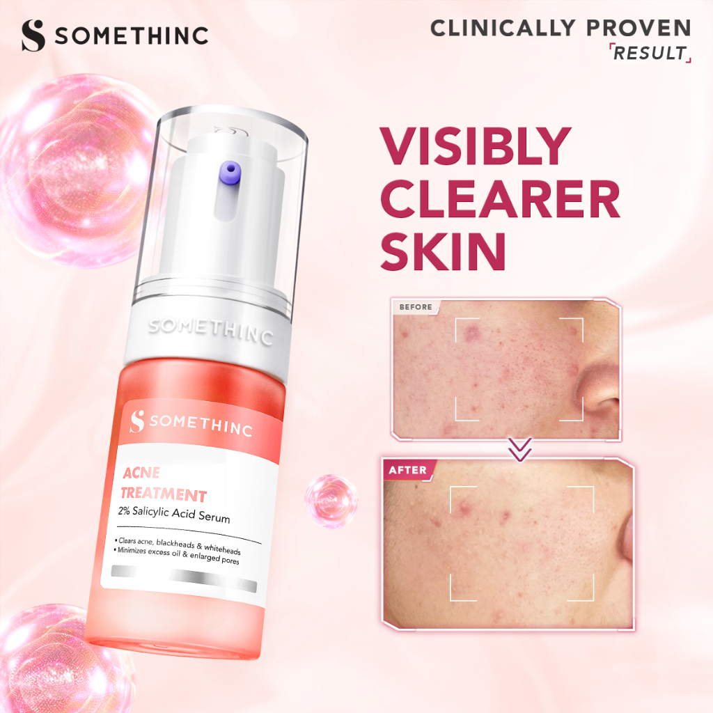 somethinc acne treatment 2% salicylic acid serum 20ml/serum wajah somethinc acne treatment 2% salicylic acid serum 20ml/serum wajah