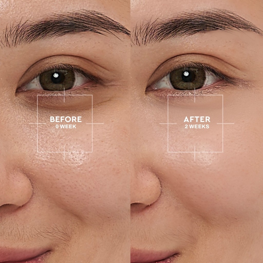 wardah renew you 1% retinol microcapsule ceramide cell renewal serum 15ml and 30ml/serum wajah wardah renew you 1% retinol microcapsule ceramide cell renewal serum 15ml and 30ml/serum wajah