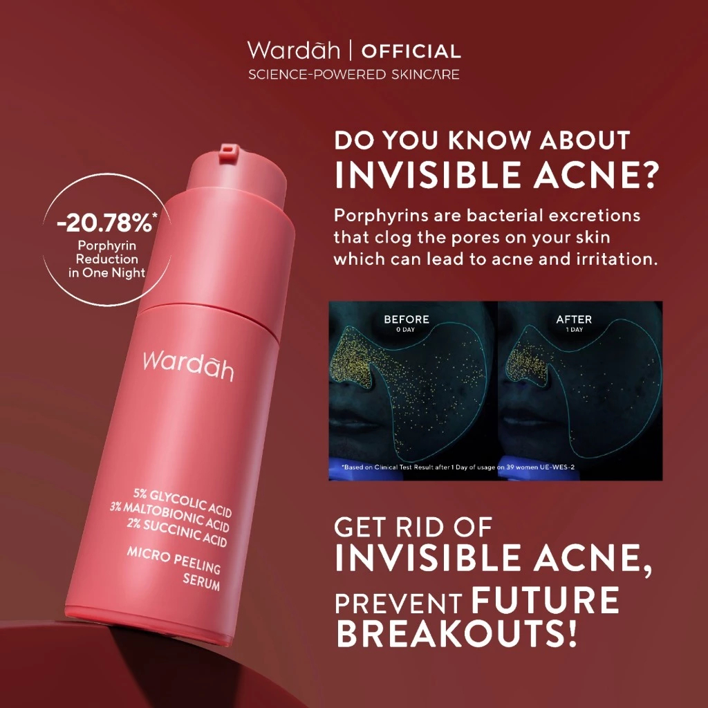 wardah 5% glycolic acid micro peeling serum 20ml/serum wajah wardah 5% glycolic acid micro peeling serum 20ml/serum wajah