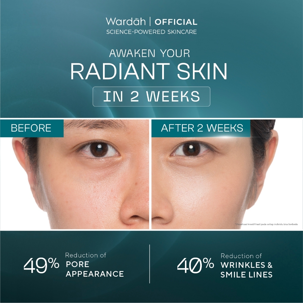 wardah retinal liposome cysteamine radiant resurfacing serum 30ml/serum wajah wardah retinal liposome cysteamine radiant resurfacing serum 30ml/serum wajah